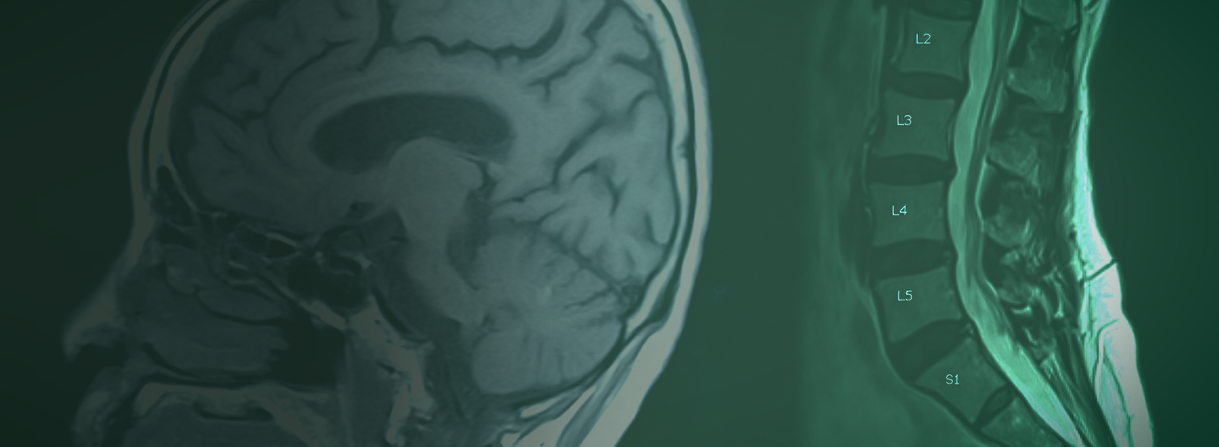 Read more about the article Quando é indicado fazer uma ressonância magnética?