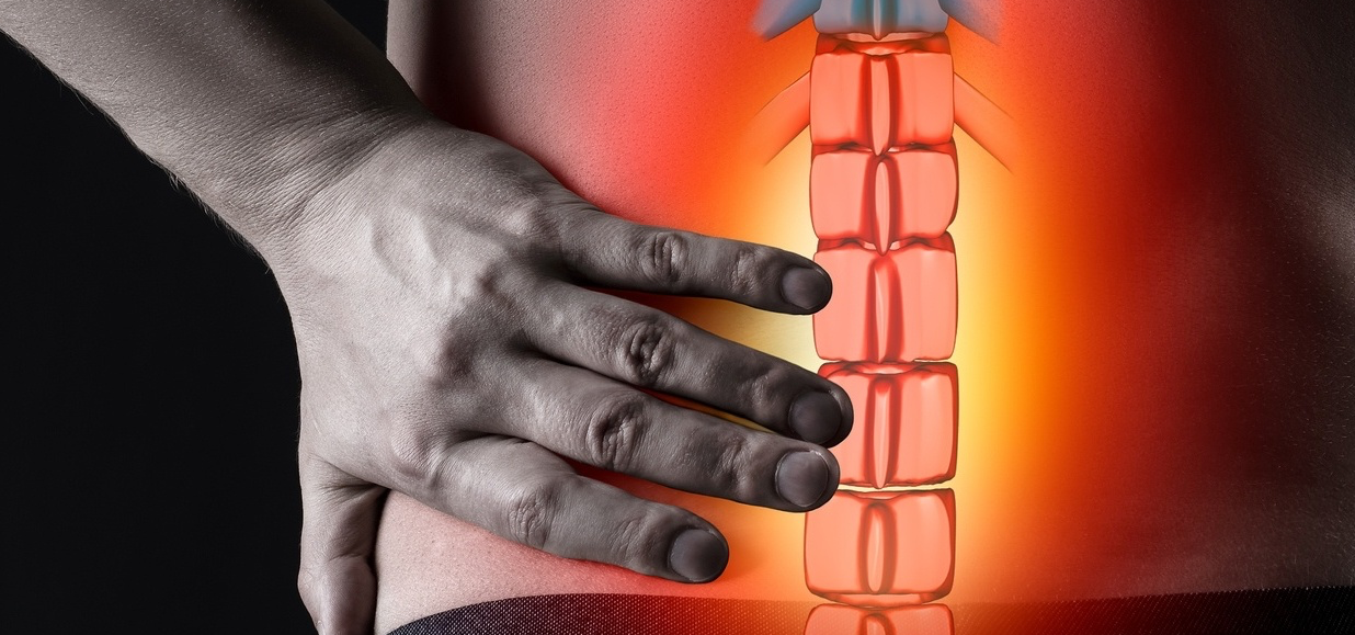 Read more about the article Toda hérnia de disco precisa ser operada?