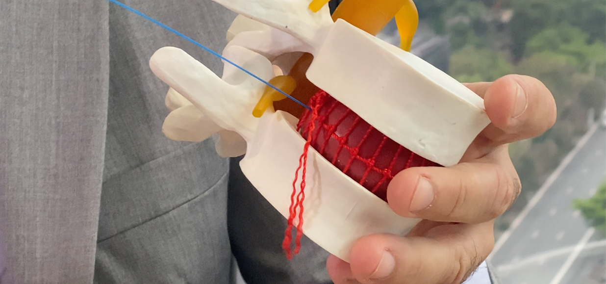 Read more about the article O que é Descompressão discal a laser?